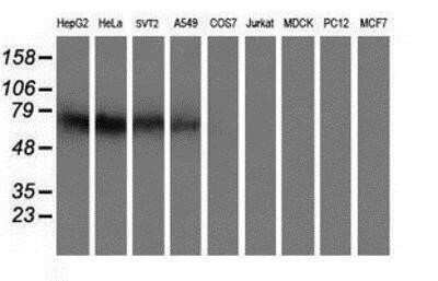 Western Blot: Iduronate 2-Sulfatase/IDS Antibody (OTI1D9) - Azide and BSA Free [NBP2-70994] - Analysis of extracts (35ug) from 9 different cell lines by using anti-Iduronate 2 sulfatase monoclonal antibody.