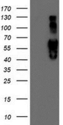Western Blot: Iduronate 2-Sulfatase/IDS Antibody (OTI1D9) - Azide and BSA Free [NBP2-70994] - HEK293T cells were transfected with the pCMV6-ENTRY control (Left lane) or pCMV6-ENTRY Iduronate 2 sulfatase (Right lane) cDNA for 48 hrs and lysed. Equivalent amounts of cell lysates (5 ug per lane) were separated by SDS-PAGE and immunoblotted with anti