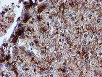 Immunohistochemistry: Iduronate 2-Sulfatase/IDS Antibody (OTI4G2) - Azide and BSA Free [NBP2-70996] - Staining of paraffin-embedded Human liver tissue using anti-Iduronate 2 sulfatase mouse monoclonal antibody.
