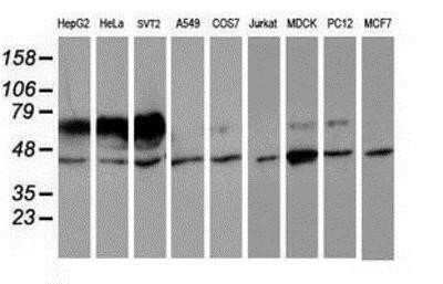Western Blot: Iduronate 2-Sulfatase/IDS Antibody (OTI4G2) - Azide and BSA Free [NBP2-70996] - Analysis of extracts (35ug) from 9 different cell lines by using anti-Iduronate 2 sulfatase monoclonal antibody.