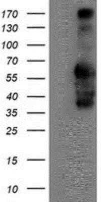 Western Blot: Iduronate 2-Sulfatase/IDS Antibody (OTI4G2) - Azide and BSA Free [NBP2-70996] - HEK293T cells were transfected with the pCMV6-ENTRY control (Left lane) or pCMV6-ENTRY Iduronate 2 sulfatase (Right lane) cDNA for 48 hrs and lysed. Equivalent amounts of cell lysates (5 ug per lane) were separated by SDS-PAGE and immunoblotted with anti