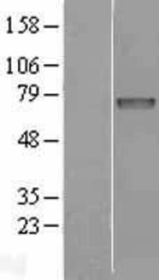 Western Blot: Iduronate 2 sulfatase Overexpression Lysate (Adult Normal) [NBL1-11823] Left-Empty vector transfected control cell lysate (HEK293 cell lysate); Right -Over-expression Lysate for Iduronate 2 sulfatase.