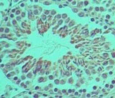 Immunohistochemistry-Paraffin Ifi204 Antibody