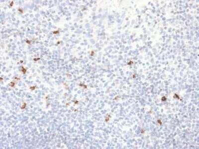 Immunohistochemistry-Paraffin: Ig gamma-4 Chain C Region Antibody (IGHG4/2042R) - Azide and BSA Free [NBP2-79850] - Formalin-fixed, paraffin-embedded human Tonsil stained with Ig gamma-4 Chain C Region Antibody (IGHG4/2042R).