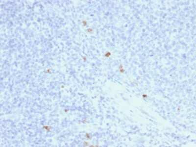 Immunohistochemistry-Paraffin: Ig gamma-4 Chain C Region Antibody (rIGHG4/1345) - Azide and BSA Free [NBP3-08668] - Formalin-fixed, paraffin-embedded human Tonsil stained with Ig gamma-4 Chain C Region Mouse Recombinant Monoclonal Antibody (rIGHG4/1345).