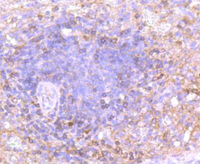 Immunohistochemistry-Paraffin: IgA Antibody (JM10-42) [NBP2-66901] - Analysis of paraffin-embedded human spleen tissue using anti-IgA antibody. Counter stained with hematoxylin.