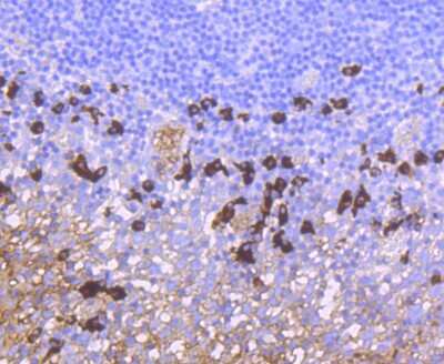 Immunohistochemistry-Paraffin: IgA Antibody (JM10-42) [NBP2-66901] - Analysis of paraffin-embedded human tonsil tissue using anti-IgA antibody. Counter stained with hematoxylin.