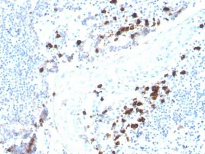 Immunohistochemistry-Paraffin: IgA Antibody (rHISA43) - Azide and BSA Free [NBP3-08604] - Formalin-fixed, paraffin-embedded human tonsil stained with IgA Recombinant Mouse Monoclonal Antibody (rHISA43).