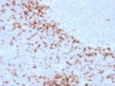 Immunohistochemistry-Paraffin: IgD Antibody (IgD26) - Azide and BSA Free [NBP3-08605] - Formalin-fixed, paraffin-embedded human Lymph Node stained with IgD Mouse Monoclonal Antibody (IGD26).