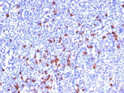 Immunohistochemistry-Paraffin: IgG Antibody (SPM556) - IHC-Prediluted [NBP2-48228] - Formalin-fixed, paraffin-embedded human Tonsil stained with IgG Monoclonal Antibody (SPM556)