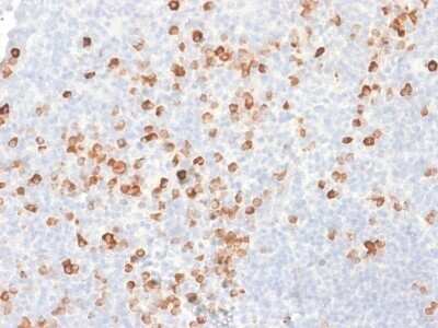 Immunohistochemistry-Paraffin: IgG Antibody (rIG266) - Azide and BSA Free [NBP2-79849] - Formalin-fixed, paraffin-embedded human Tonsil stained with IgG Antibody (rIG266).