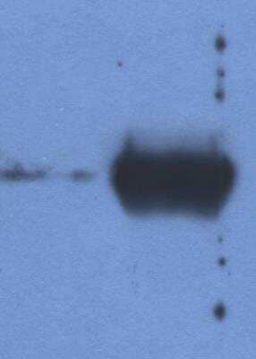 Western Blot: IgG Light Chain Antibody (IVA285-1) [NBP2-62190] - Detection of IgG light chain in reduced samples of Fetal Calf Serum (left lane) and Bovine Serum (right lane) by antibody IVA285-1. This antibody is a suitable tool for in-house quality controls of Fetal Calf Serum (Hybridoma Cell Culture grade).