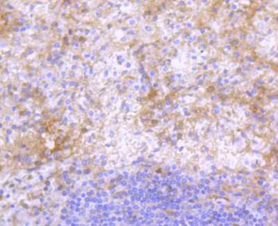 Immunohistochemistry-Paraffin: IgG4 Antibody (ST05-12) [NBP2-67527] - Analysis of paraffin-embedded human spleen tissue using anti-IgG4 antibody. Counter stained with hematoxylin.