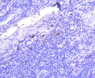 Immunohistochemistry-Paraffin: IgG4 Antibody (ST05-12) [NBP2-67527] - Analysis of paraffin-embedded human tonsil tissue using anti-IgG4 antibody. Counter stained with hematoxylin.