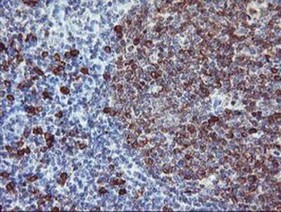 Immunohistochemistry-Paraffin: IgJ Antibody (3B3) [NBP2-01688] Staining of paraffin-embedded Human tonsil using anti-IgJ mouse monoclonal antibody.