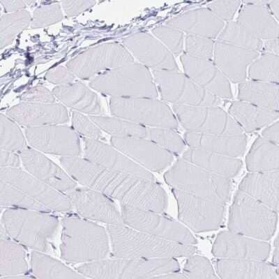<b>Orthogonal Strategies Validation. </b>Immunohistochemistry-Paraffin: IgJ Antibody [NBP2-38523] - Staining of human skeletal muscle shows low expression as expected.