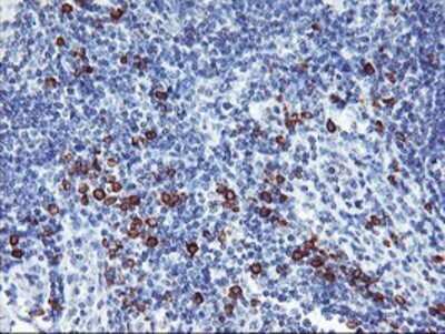 Immunohistochemistry: IgJ Antibody (OTI3B3) - Azide and BSA Free [NBP2-71016] - Staining of paraffin-embedded Human lymphoma tissue using anti-IgJ mouse monoclonal antibody.