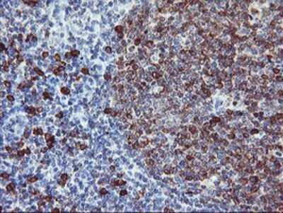 Immunohistochemistry: IgJ Antibody (OTI3B3) - Azide and BSA Free [NBP2-71016] - Staining of paraffin-embedded Human tonsil using anti-IgJ mouse monoclonal antibody.