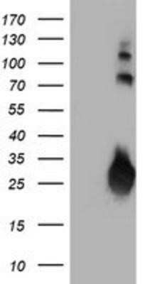 Western Blot: IgJ Antibody (OTI3B3) - Azide and BSA Free [NBP2-71016] - HEK293T cells were transfected with the pCMV6-ENTRY control (Left lane) or pCMV6-ENTRY IgJ (Right lane) cDNA for 48 hrs and lysed. Equivalent amounts of cell lysates (5 ug per lane) were separated by SDS-PAGE and immunoblotted with anti-IgJ.