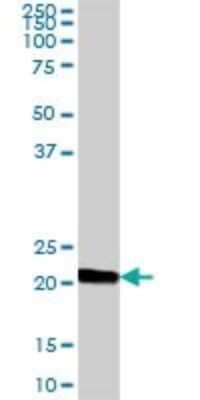 Western Blot: IgJ Antibody [H00003512-B01P] - Analysis of IGJ expression in human colon.