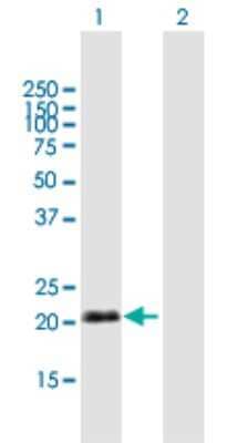 Western Blot: IgJ Antibody [H00003512-B01P] - Analysis of IGJ expression in transfected 293T cell line by IGJ polyclonal antibody.  Lane 1: IGJ transfected lysate(17.49 KDa). Lane 2: Non-transfected lysate.