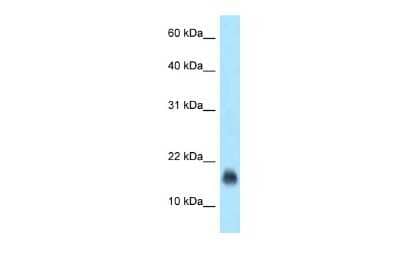 Western Blot: IgJ Antibody [NBP2-87622] - WB Suggested Anti-IGJ Antibody. Titration: 1.0 ug/ml. Positive Control: Jurkat Whole Cell