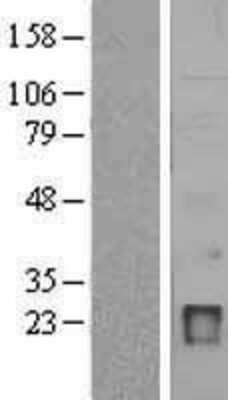 Western Blot: IgJ Overexpression Lysate (Adult Normal) [NBL1-11879] Left-Empty vector transfected control cell lysate (HEK293 cell lysate); Right -Over-expression Lysate for IgJ.