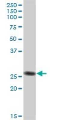 Western Blot: IgL Antibody [H00003535-B01P] - Analysis of IGL@ expression in human liver.