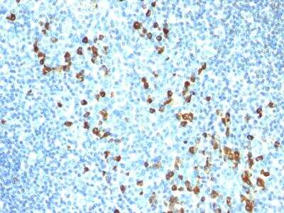 Immunohistochemistry-Paraffin: IgM Antibody (ICO-30) - IHC-Prediluted [NBP2-48239] - Formalin-fixed, paraffin-embedded human Tonsil stained with IgM Mouse Monoclonal Antibody (ICO-30).