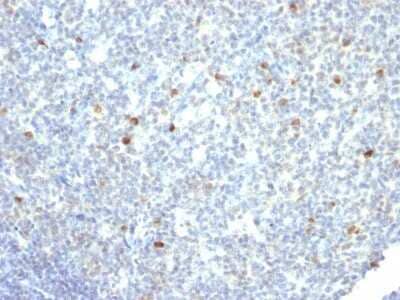 Immunohistochemistry-Paraffin: IgM Antibody (IM260) - IHC-Prediluted [NBP2-45057] - Formalin-fixed, paraffin-embedded human tonsil stained with IgM Antibody (IM260)