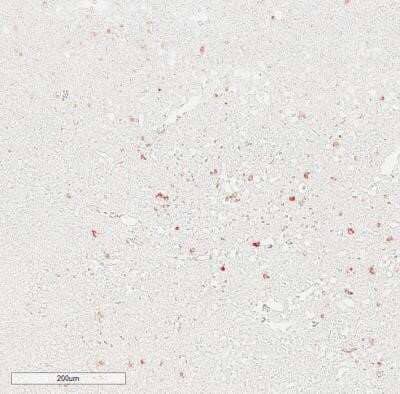 Immunohistochemistry-Paraffin: IgM Antibody (IM260) - IHC-Prediluted [NBP2-45057] - Human lymph node. IgM antibody at 1:200 at RT for 1 hr. IHC-P image submitted by a verified customer review.