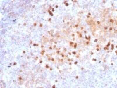 Immunohistochemistry-Paraffin: IgM Antibody (IM373) - IHC-Prediluted [NBP2-45059] - Formalin-fixed, paraffin-embedded human Tonsil stained with IgM Monoclonal Antibody (IM373)