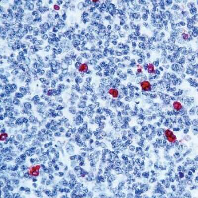 Immunohistochemistry-Paraffin: IgM Antibody [NB120-17150] - Formalin fixed paraffin embedded human tonsil stained with IgM antibody.