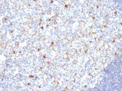 Immunohistochemistry-Paraffin: IgM Antibody (SPM188) - IHC-Prediluted [NBP2-48240] - Formalin-fixed, paraffin-embedded human Tonsil stained with IgM Monoclonal Antibody (SPM188)