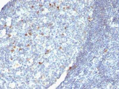 Immunohistochemistry-Paraffin: IgM Heavy Chain Antibody (IM260 + IM373 + ICO-30) - IHC-Prediluted [NBP2-48241] - Formalin-fixed, paraffin-embedded human Tonsil stained with IgM Mouse Monoclonal Antibody (Cocktail)