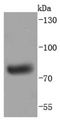 Western Blot: IgM Heavy Chain Antibody (JF84-09) [NBP2-66902] - Analysis of Human IgM on human plasma lysates using anti-Human IgM antibody at 1/1,000 dilution.