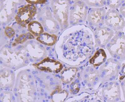 Immunohistochemistry-Paraffin: IkB-alpha Antibody (SZ00-07) [NBP2-67369] - Analysis of paraffin-embedded human kidney tissue using anti-IKB alpha antibody. Counter stained with hematoxylin.