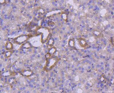 Immunohistochemistry-Paraffin: IkB-alpha Antibody (SZ00-07) [NBP2-67369] - Analysis of paraffin-embedded mouse kidney tissue using anti-IKB alpha antibody. Counter stained with hematoxylin.