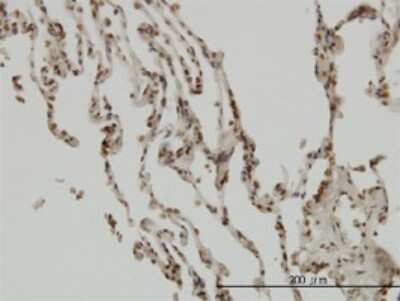 Immunohistochemistry-Paraffin: IkB-beta Antibody (1B5) [H00004793-M01] - Analysis of monoclonal antibody to NFKBIB on formalin-fixed paraffin-embedded human lung. Antibody concentration 5 ug/ml.