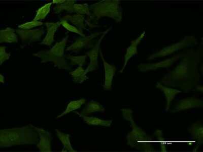 Immunocytochemistry/Immunofluorescence: IkB-beta Antibody (1G6) [H00004793-M06] - Analysis of monoclonal antibody to NFKBIB on HeLa cell. Antibody concentration 40 ug/ml