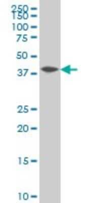 Western Blot: IkB-beta Antibody (2B11) [H00004793-M02] - NFKBIB monoclonal antibody (M02), clone 2B11 Analysis of NFKBIB expression in HL-60.