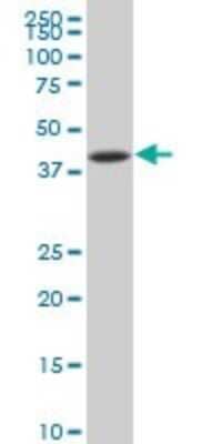 Western Blot: IkB-beta Antibody (3B5) [H00004793-M04] - Analysis of NFKBIB expression in HL-60 (Cat # L014V1).