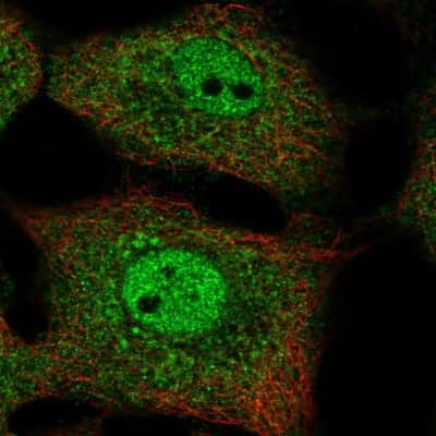 Immunocytochemistry/Immunofluorescence: IkB-beta Antibody [NBP2-57108] - Staining of human cell line A549 shows localization to nucleoplasm & cytosol.