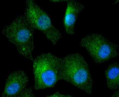 Immunocytochemistry/Immunofluorescence: IkB-beta Antibody (SN0648) [NBP2-67645] - Staining IKB beta in A549 cells (green). The nuclear counter stain is DAPI (blue). Cells were fixed in paraformaldehyde, permeabilised with 0.25% Triton X100/PBS.