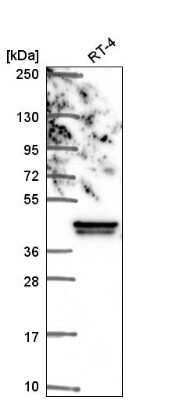 Western Blot: IkB-beta Antibody [NBP2-57108] - Western blot analysis in human cell line RT-4.