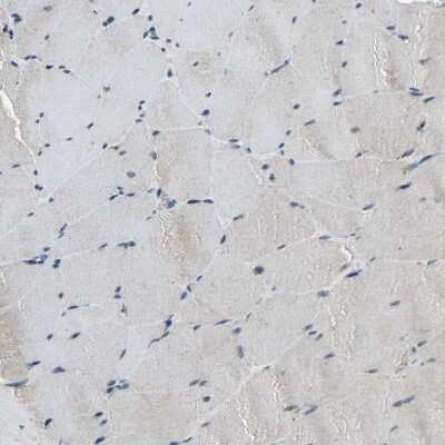 Immunohistochemistry-Paraffin: IkB-epsilon Antibody [NBP1-87762] - Staining of human skeletal muscle shows very weak positivity in myocytes as expected.