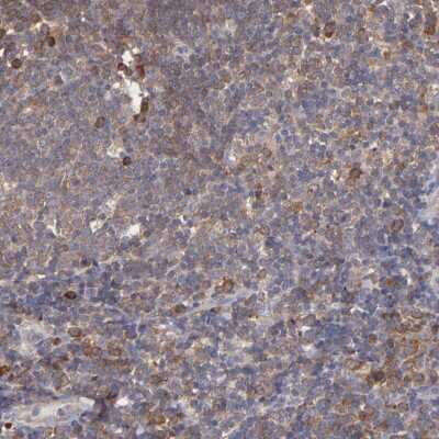 Immunohistochemistry-Paraffin: IkB-epsilon Antibody [NBP1-87763] - Staining of human tonsil shows moderate cytoplasmic positivity.