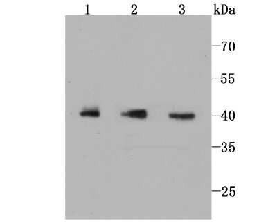 Western Blot: IkB-epsilon Antibody (JM62-63) [NBP2-66903] - Analysis of IKB epsilon on different cell lysates using anti-IKB epsilon antibody at 1/1,000 dilution. Positive control: Line 1: THP-1 Line 2: Jurkat Line 3: Hela
