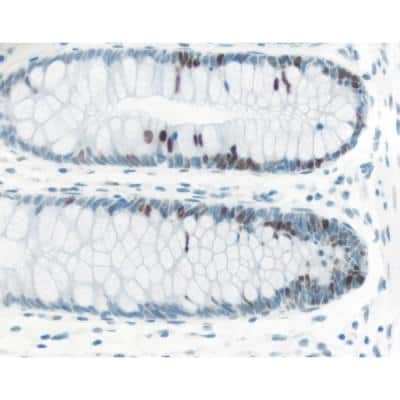 Immunohistochemistry: ImmPRESS(TM) Excel anti-Rabbit IgG Staining Kit (Colorimetric) [MP-7601-NB]