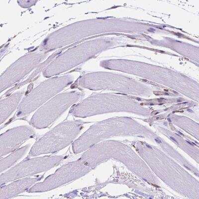 Immunohistochemistry-Paraffin: Importin 11 Antibody [NBP2-49505] - Staining of human skeletal muscle shows no positivity in myocytes as expected.